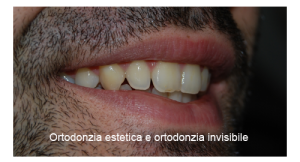 5-ortodonzia